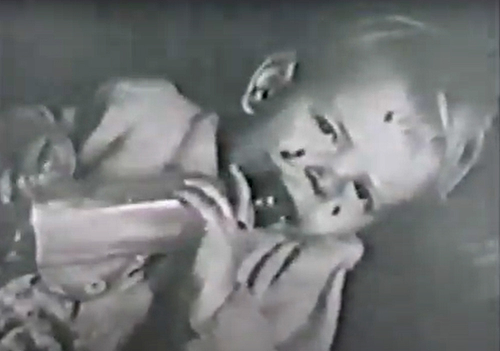This is a still image from the film Beautiful Melbourne. It shows a toddler crawling with house lice on him.
